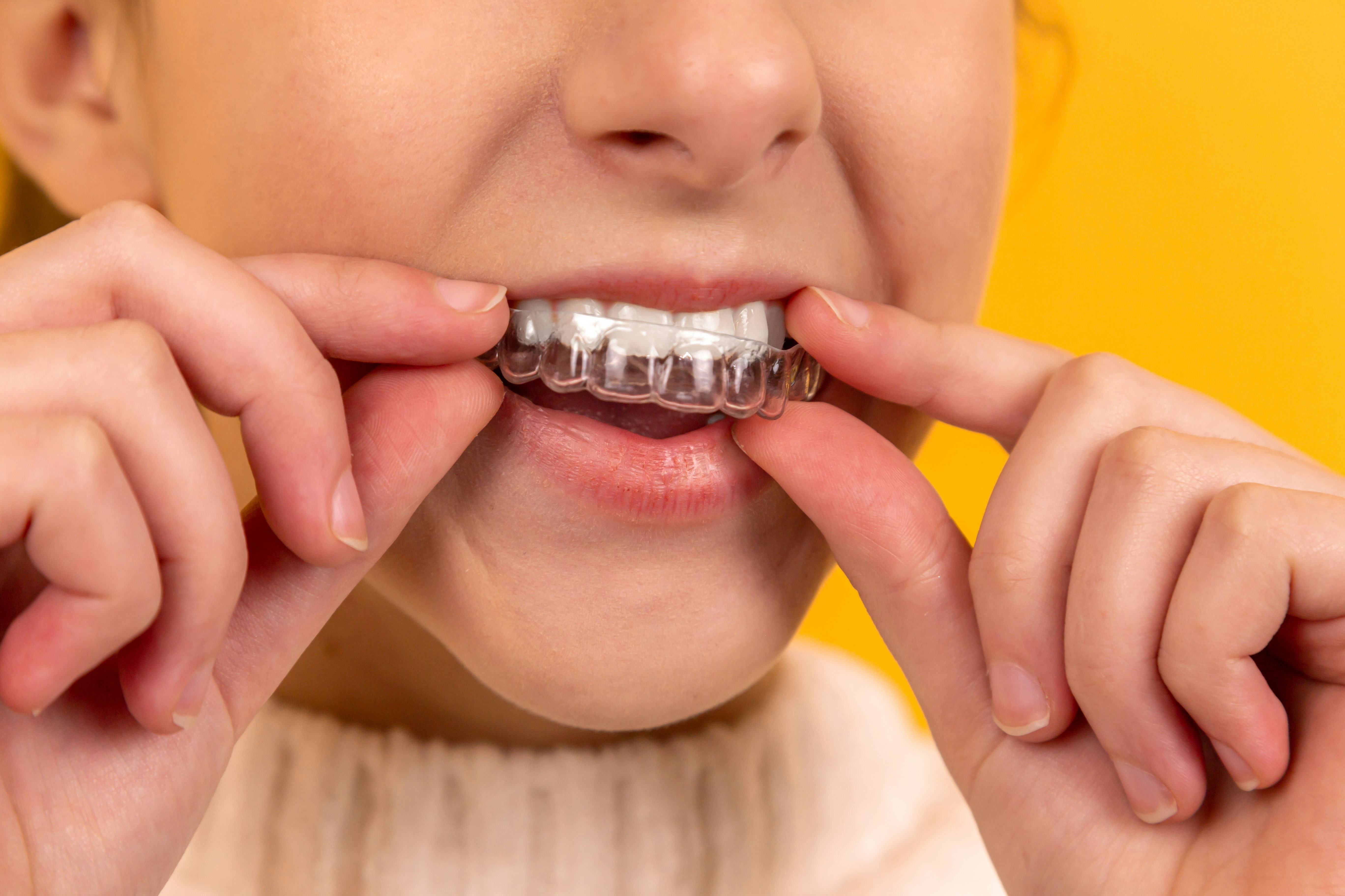 Digital Orthodontic Solutions