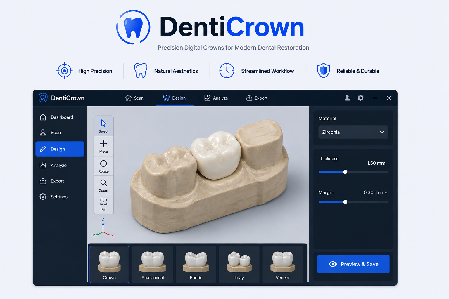 DentiCrown Dental Restoration Software
